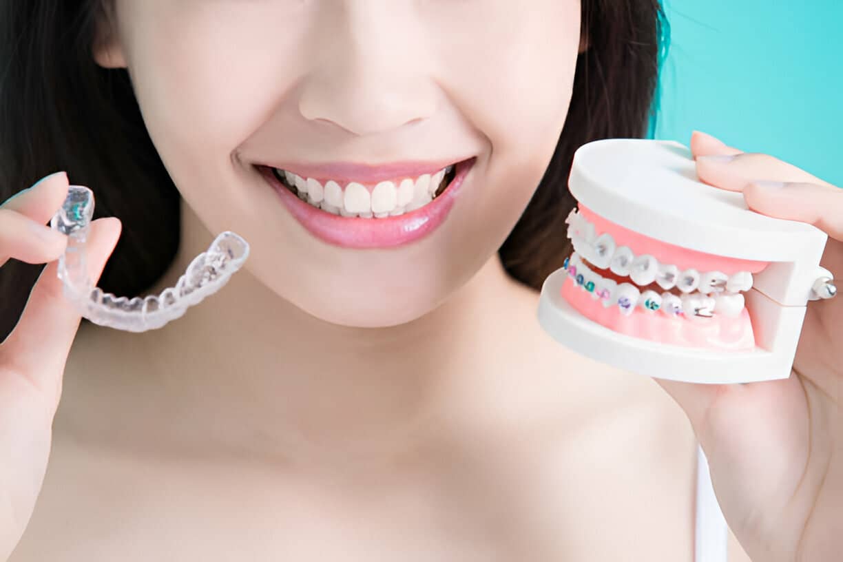 Invisalign vs. Traditional Braces: Which Is Right for You?