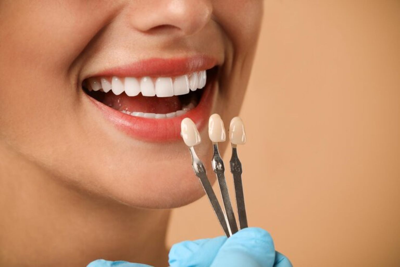 Step-by-Step Guide to Getting Veneers: What to Expect at Each Visit